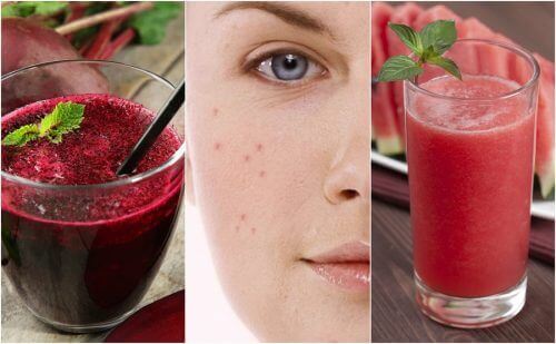 Bekjemp akne ved å legge 5 detox-smoothier til i kostholdet ditt