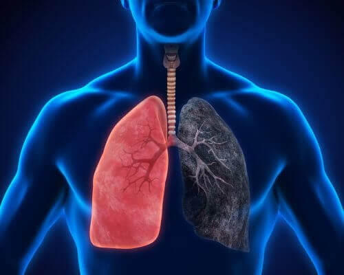 8 symptomer på lungebetennelse som du ikke bør ignorere