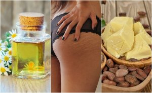 Reduser strekkmerker med disse 5 hjemmeremediene