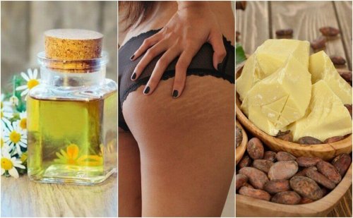 Reduser strekkmerker med disse 5 hjemmeremediene