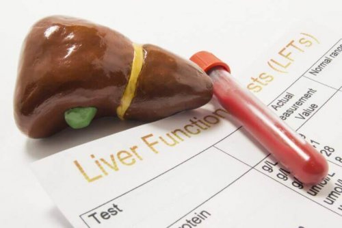 5 årsaker til forhøyet verdi av alkalisk fosfatase