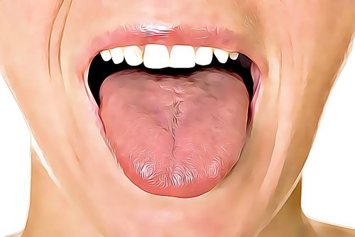 6 naturlige måter å bli kvitt munnsår på