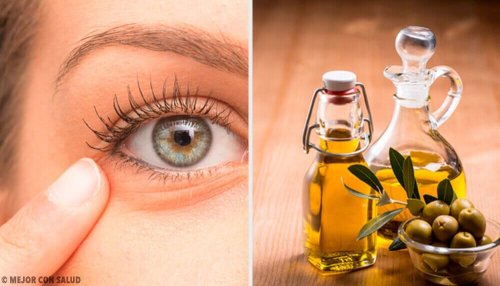 6 naturlige remedier mot øyebetennelse