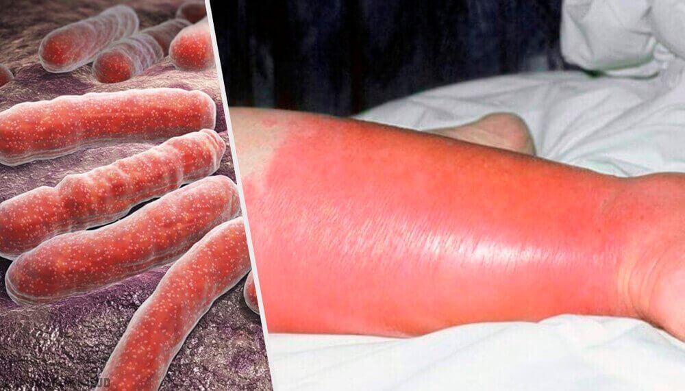 Rosen: Problemer og løsninger