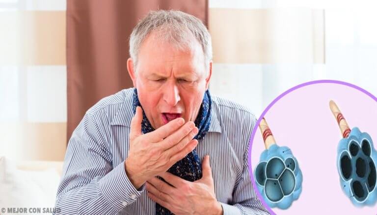 Kronisk obstruktiv lungesykdom (KOLS)