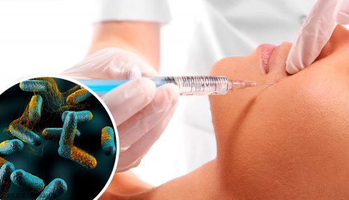 Botulinumtoksin, en dødelig gift