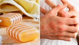 Hjemmelaget såpe for å bekjempe dermatitt