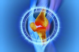 Rehabilitering av knærne etter en meniskoperasjon