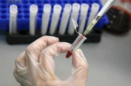 Er det mulig å utrydde HIV med en stamcelletransplantasjon?