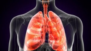 Hva er lungepest?