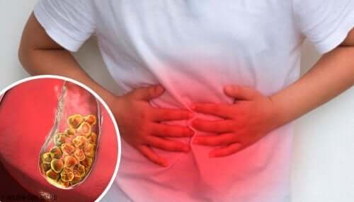 Smerter i høyre side av magen, skulderen og ryggen kan være symptomer på at du lider av gallestein.