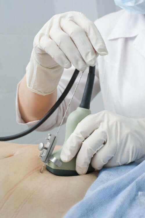 molar graviditetsdiagnose