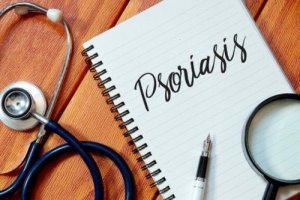 Fem måter å holde psoriasis i sjakk på