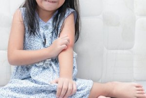 Råd for å håndtere psoriasis hos barn