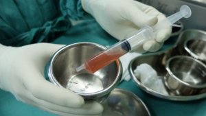 Informasjon og trinn for å behandle ascites