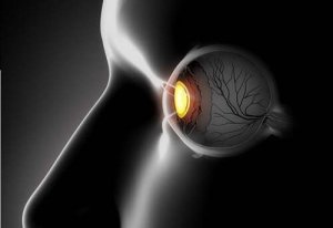 Symptomer på og behandlinger for skjeløydhet