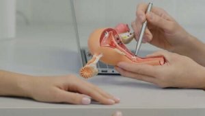 Polycystisk ovariesyndrom: symptomer og behandling