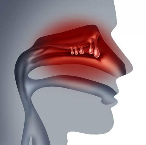 Administrering av medisiner gjennom nesen fungerer godt for pasienter som har problemer med å svelge.