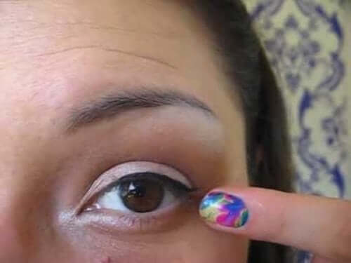 Kvinne peker mot et øyelokk med blefaritt