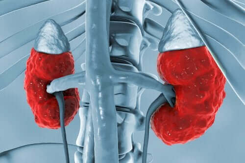 Proksimal renal tubulær acidose.