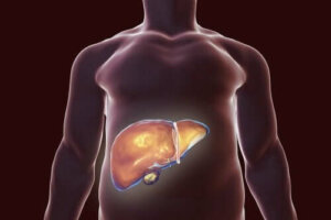 Kosthold for galleblæren: Hva du bør gjøre og ikke gjøre