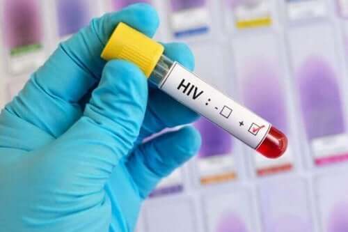 Hiv-blodprøve.