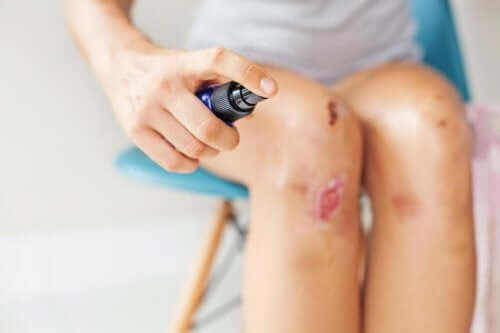 Hva du bør og ikke bør gjøre når du behandler et sår