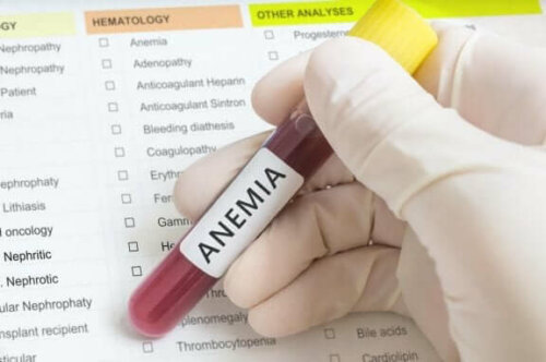 Blodprøve for anemi