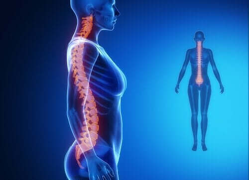Diagnostisering og behandling av artrose i ryggraden