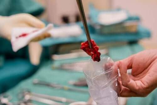 Hva er flytende biopsi?