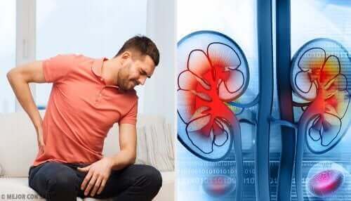 En mann med ryggsmerter på grunn av en nyreinfeksjon.