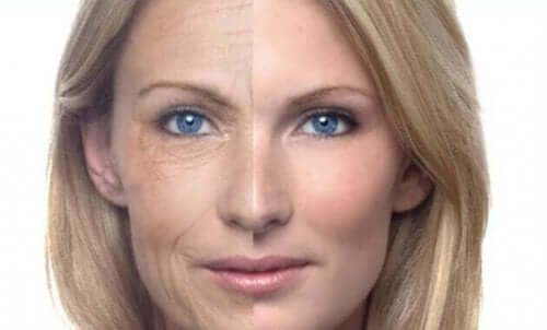Før-og-etter bilde av hude til en kvinne