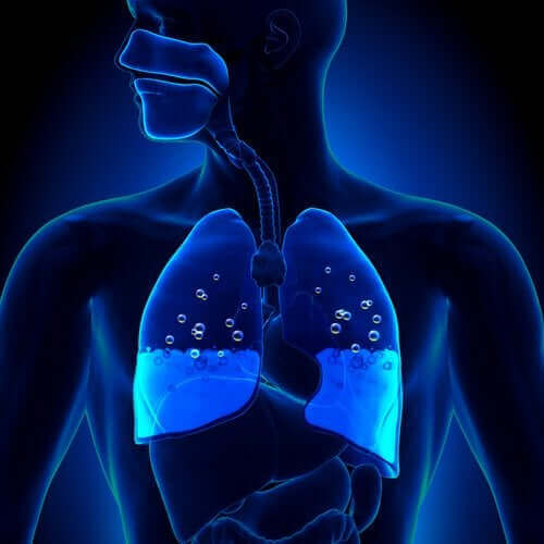 Årsaker og symptomer på lungeødem