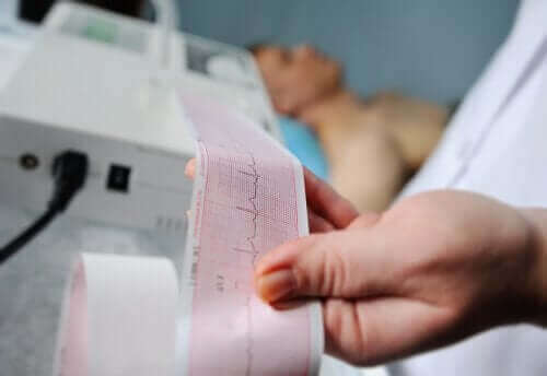 Elektrokardiogram.