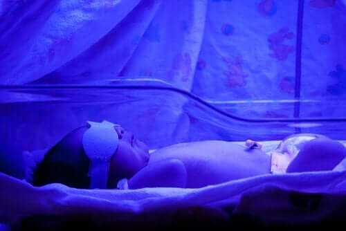 Gulsott hos nyfødte: dette bør du vite