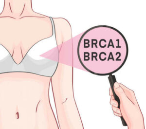 BRCA1- og BRCA2-gener og brystkreft