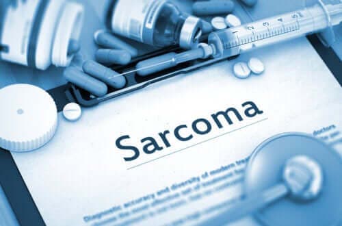 Sarkom: Kjennetegn og årsaker