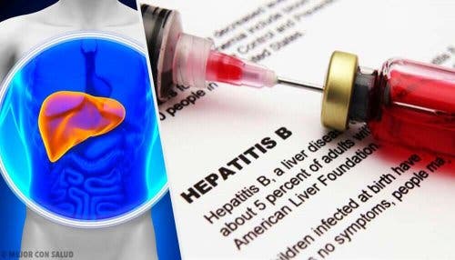En representasjon av hepatitt B.