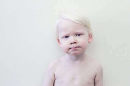 Et albinobarn som lener seg mot en hvit vegg.