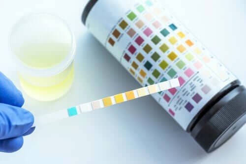 Hva kan oppdages med en urinanalyse?