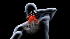 Behandling og forebygging av muskelkontrakturer