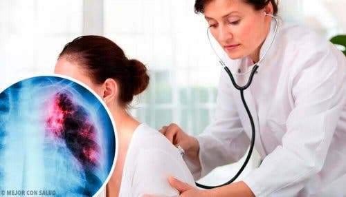 Røntgen av en lungeknute.