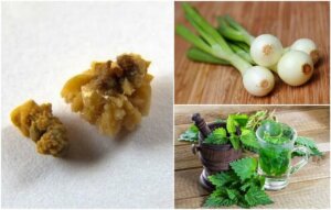 Bekjemp urinsyrekrystaller med disse naturlige preparatene