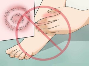 Alt du trenger å vite om å behandle erysipelas