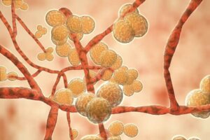 Alt du trenger å vite om candida auris