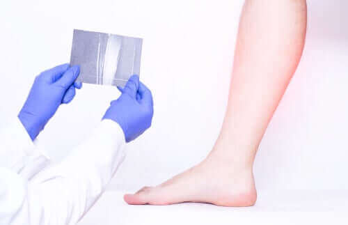 En medisinsk test av leggmuskulatur.