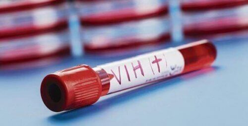 hiv-positivt blod