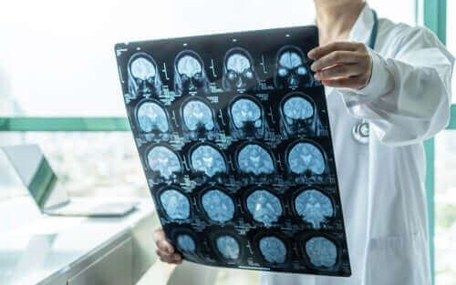 Røntgen av hjernen