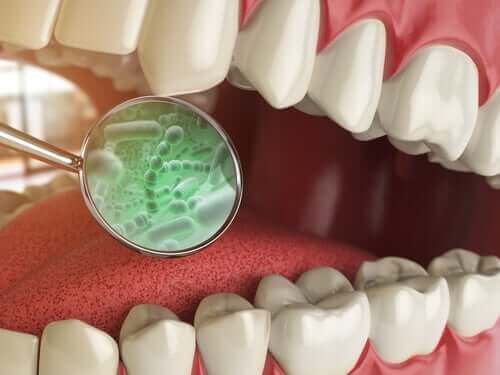 Bakterier i munnen: Dette er de ulike typene du finner der