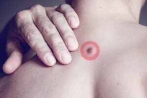 Årsaken til fettklumper på ryggen